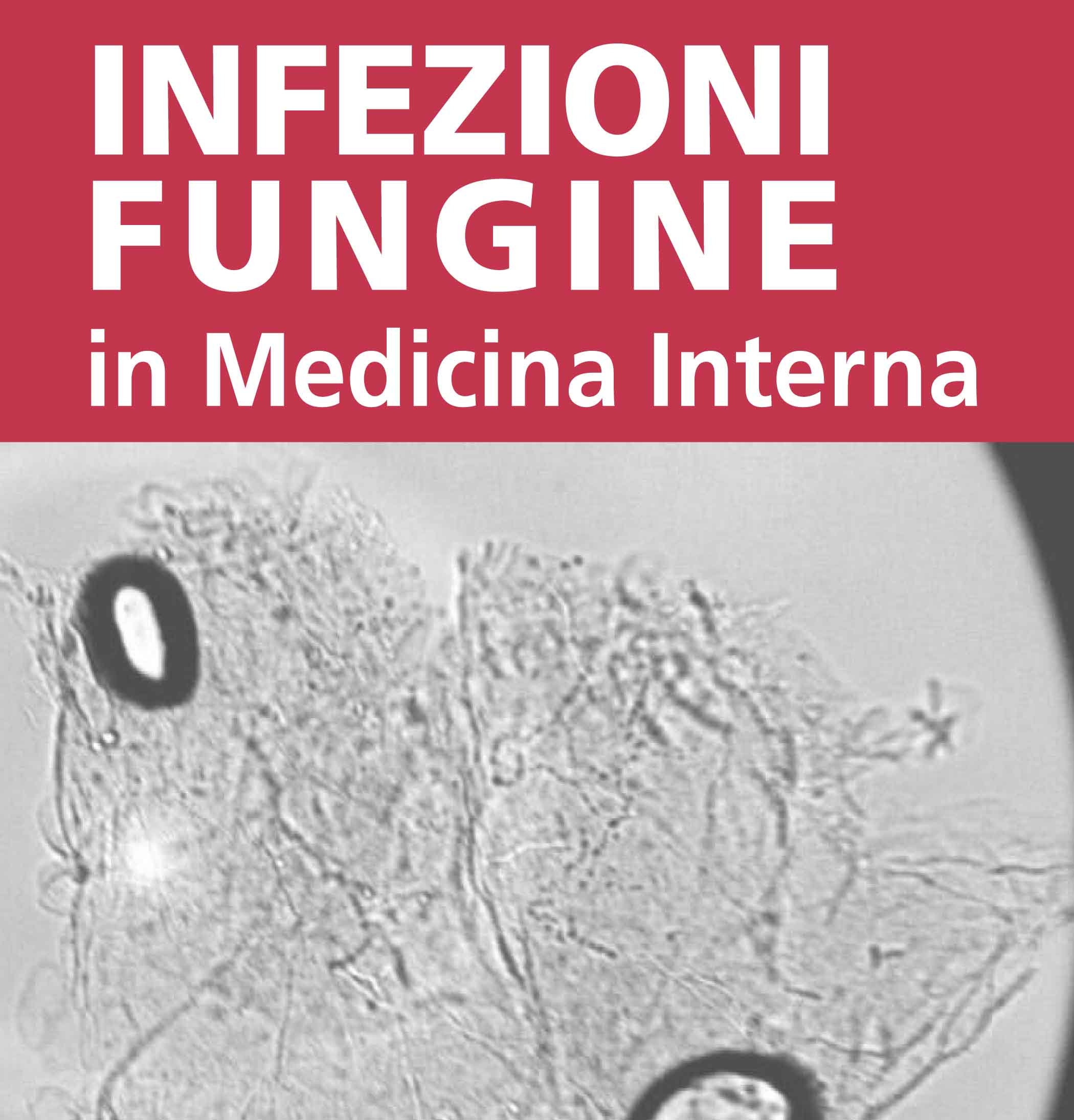 Infezioni fungine in Medicina Interna